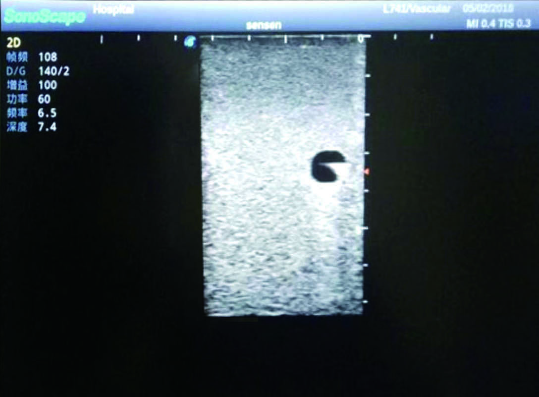 PICC Ultrasound Training Model 