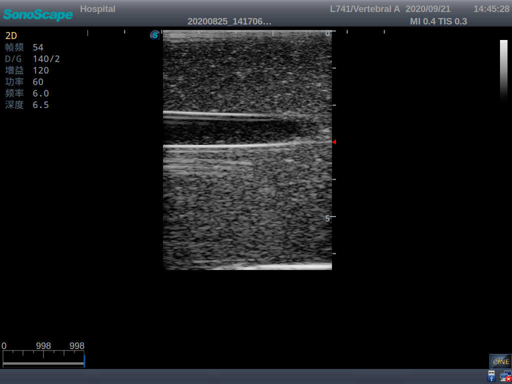 Vascular Access Ultrasound Training Model