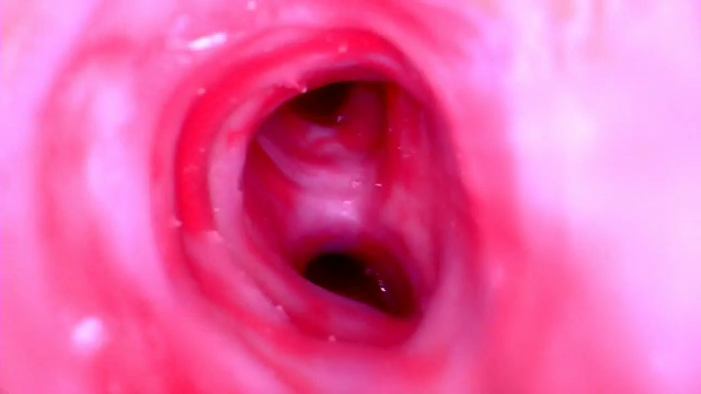 Simulated Bronchoscopy Model